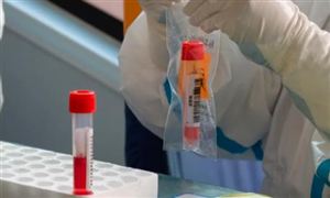 不锈钢行业调研分析 2022不锈钢行业开云APP 开云官网入口分析报告(图6)